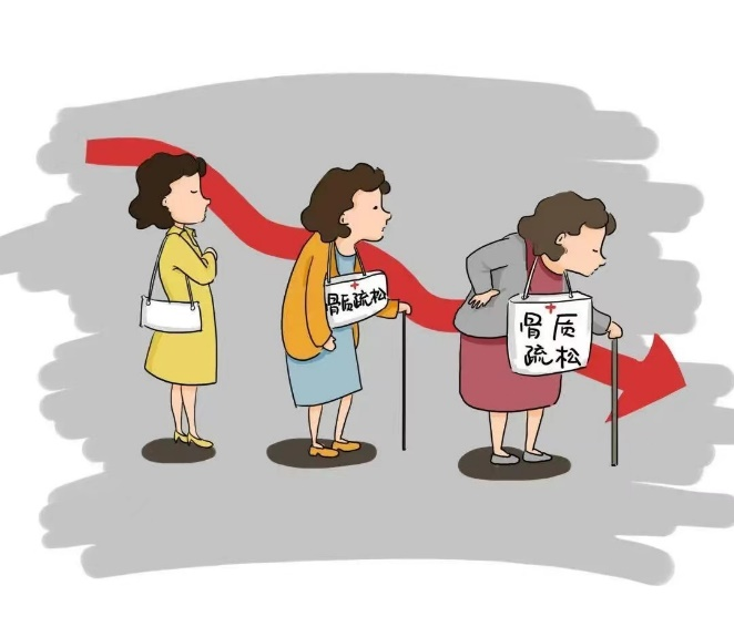 禾柏全血25-羥基維生素D，助力骨骼健康